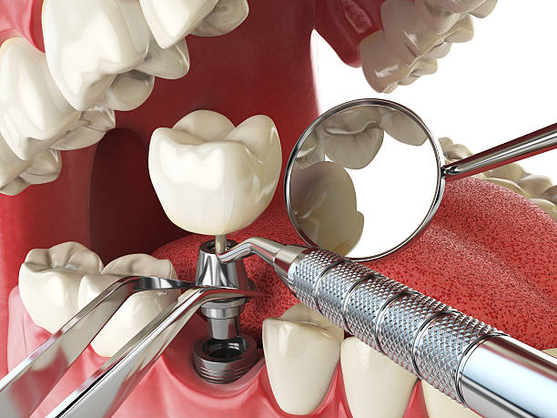 Best Walk-In Emergency Dental Services in Cumings, TX